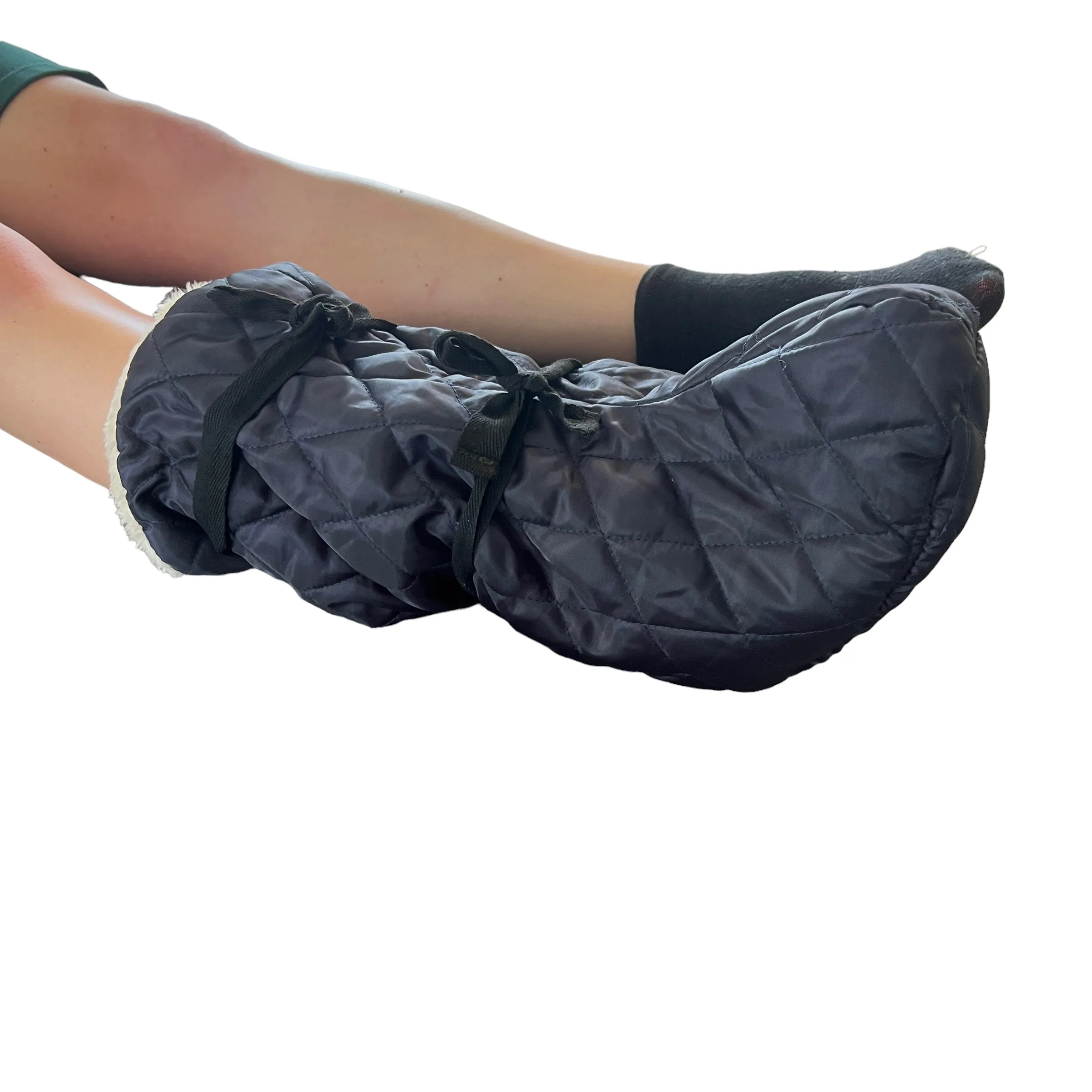 Fleece Cast Cover — Leg Pop