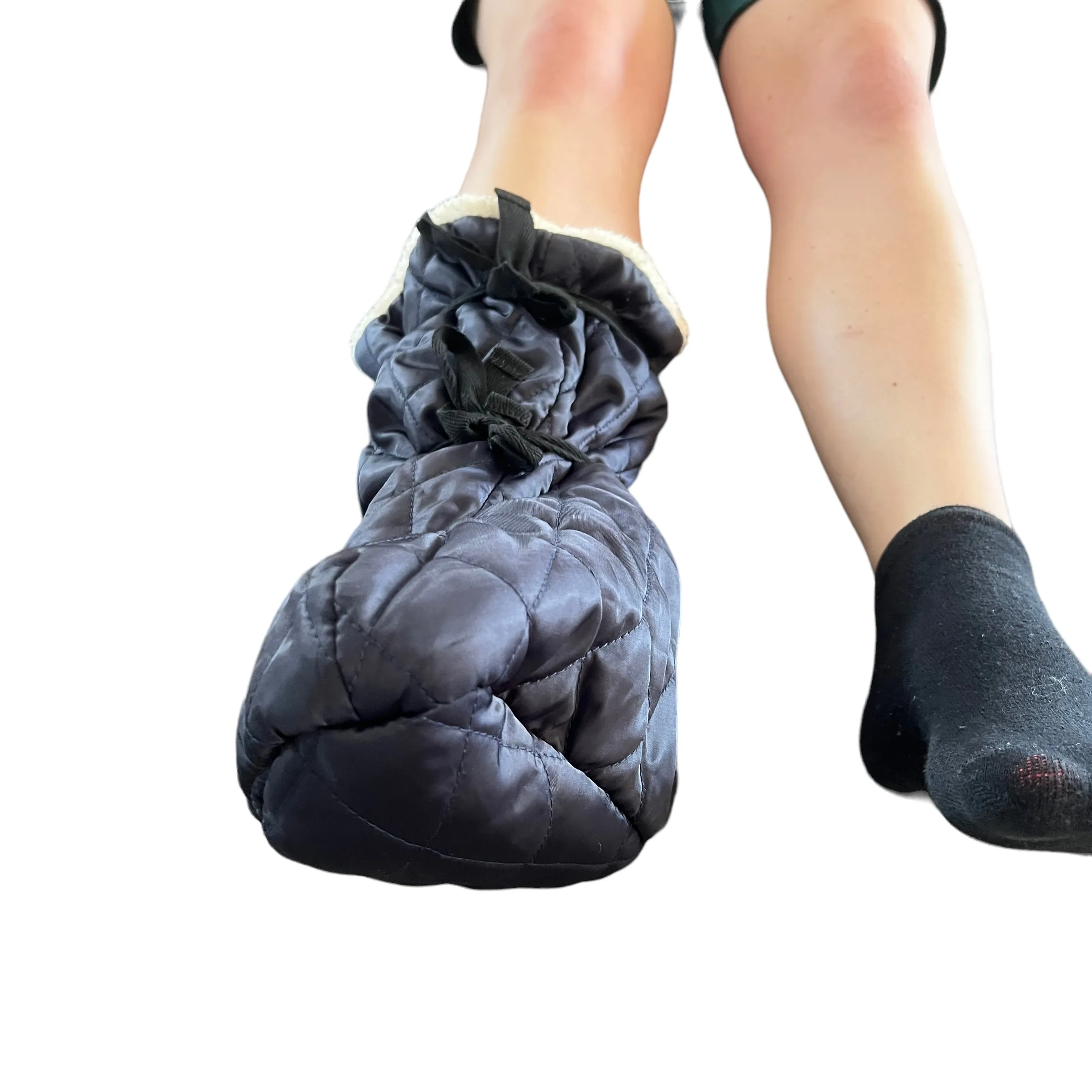 Fleece Cast Cover — Leg Pop